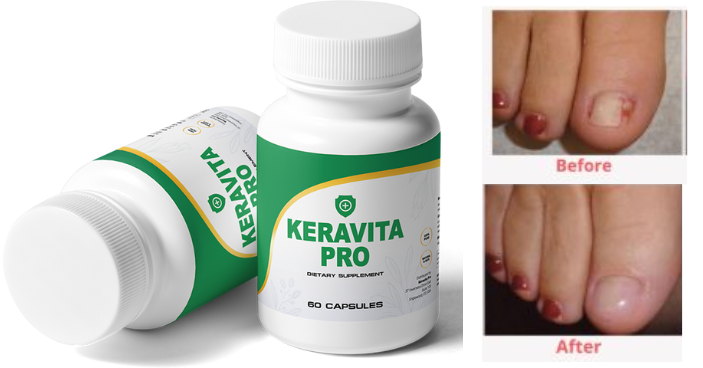 Keravita Pro Before and after